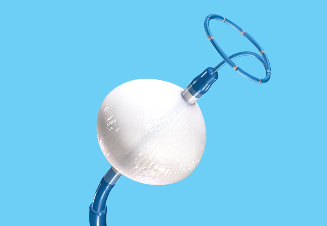 عمل کرایو cryo